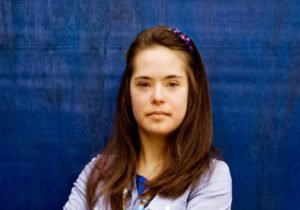 Down syndrome trisomy
