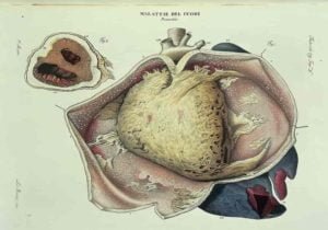 Heart diseases | List of cardiovascular diseases | Include pathologies that affect the heart and all of the blood vessels