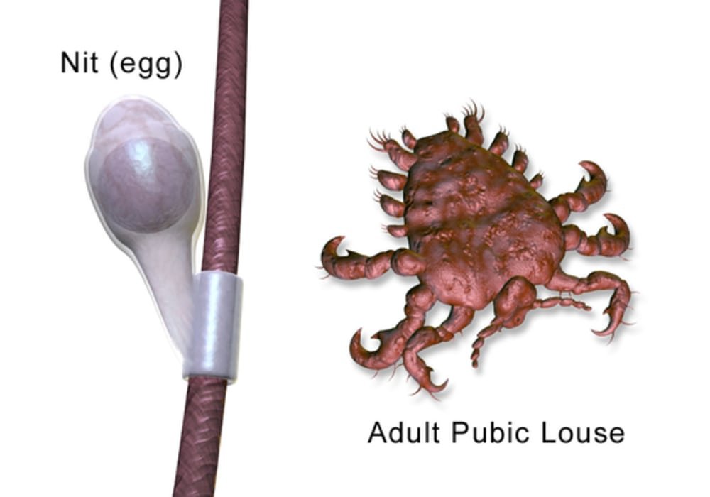 Adult public lice and nit