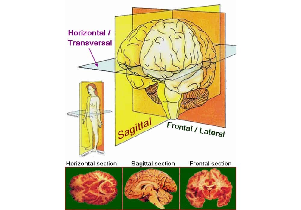 Progressive Supranuclear Palsy (PSP) | Rare Brain Disorder
