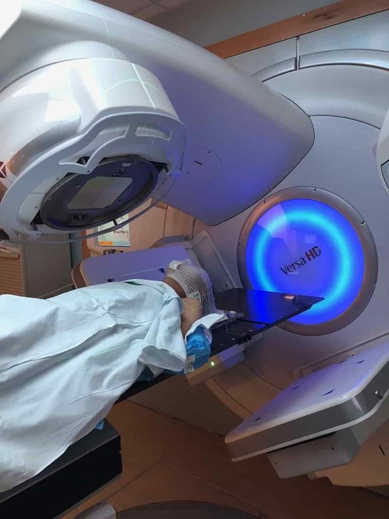 Radiotherapy | Radiation Therapy for Cancer | How Does It Work?