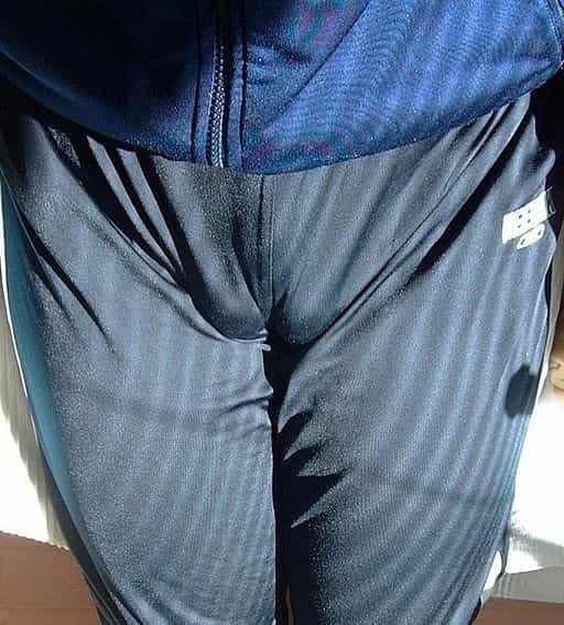 Sagging Testicles | My balls are hanging down, what should I do?