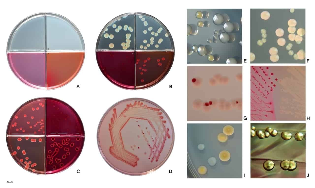 Escherichia Coli (E Coli Bacteria)