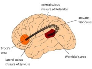 Broca wernicke aphasia
