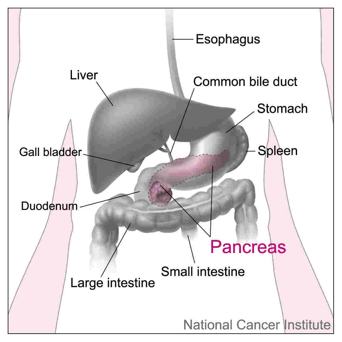 Bile Duct Cancer (Cholangiocarcinoma): Causes, Symptoms, and Treatment